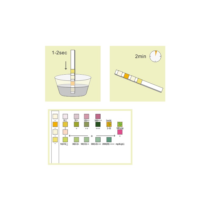 Urinary tract infection test