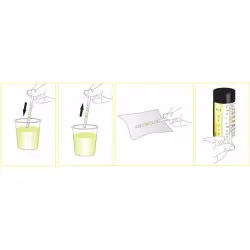 Urine strips 11 parameters 100 strips/kit 2