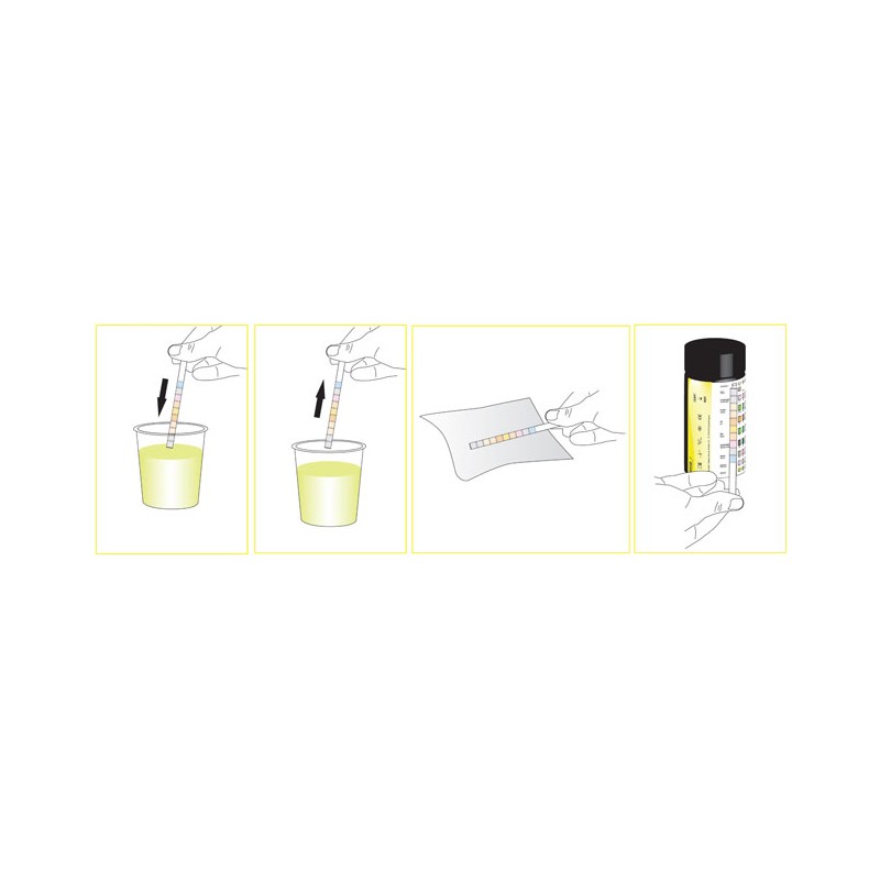 Urine strips 11 parameters 100 strips/kit