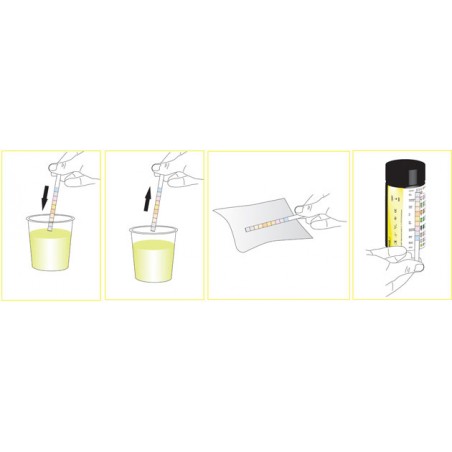 Urine strips 11 parameters 100 strips/kit