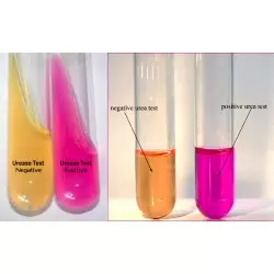 Hpylori CLO test liquid form in biopsy samples kit of 25 2